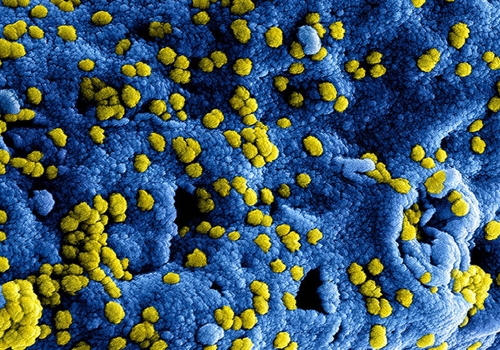 De Achterhoekse Wandelvierdaagse gaat niet door in 2020